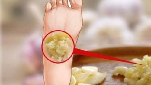 công dụng tuyệt vời từ tỏi ít người biết